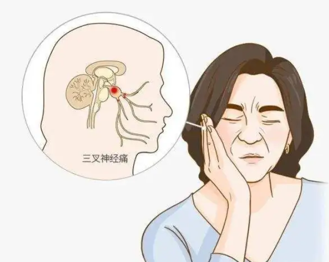三叉神经.png